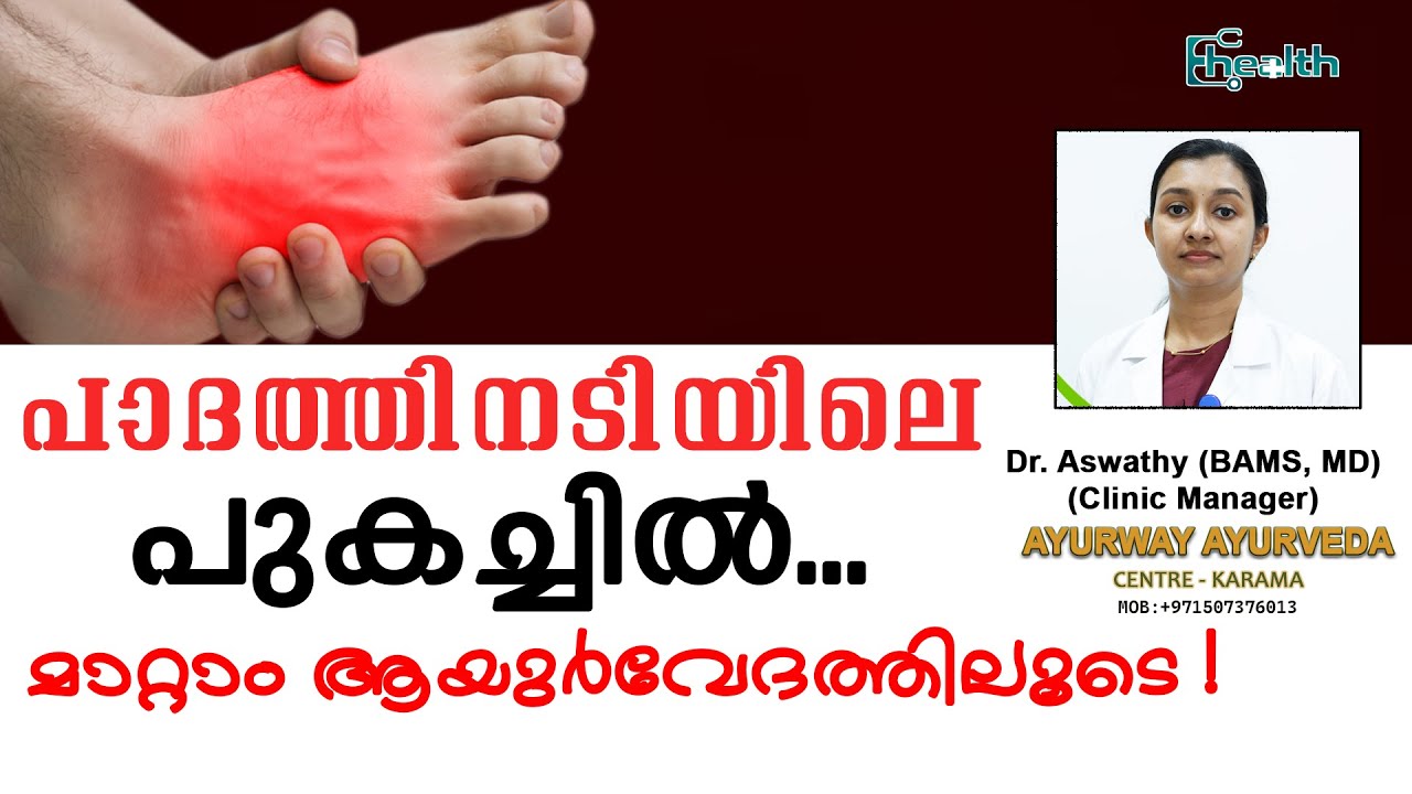 പാദത്തിനടിയിലെ .പുകച്ചിൽ ...മാറ്റം ആയുർവേദത്തിലൂടെ !