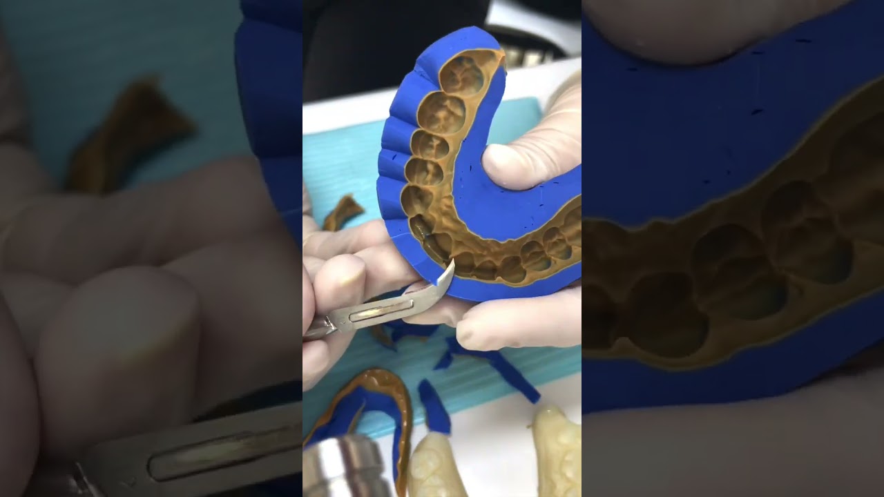 How to make a DSD mock-up putty key? (Part 3) #dentistry #cosmeticdentistry #veneers #smilemakeover