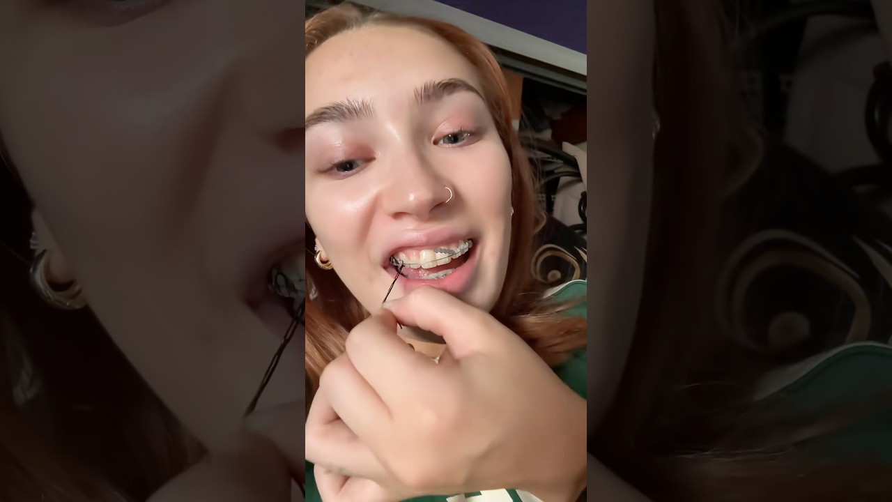 Doing This Could DELAY Your Braces Treatment! 😭🦷