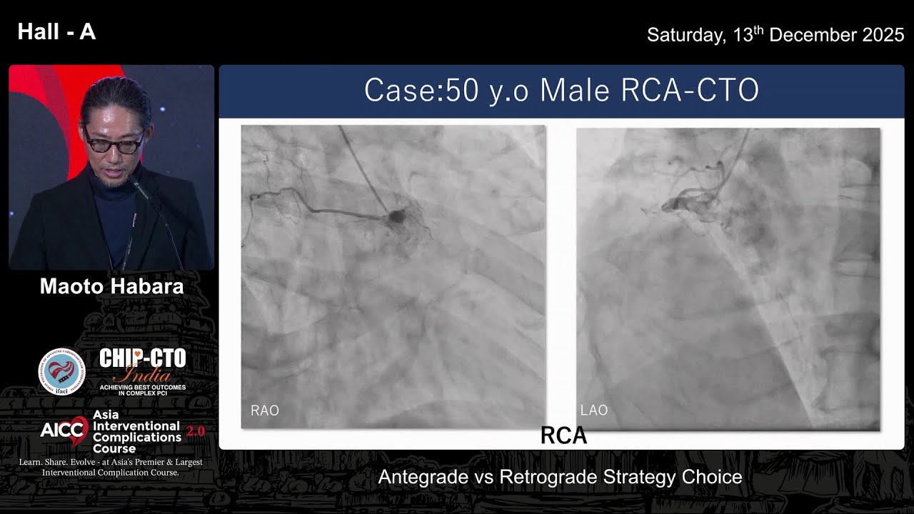 When to Go Retrograde? | Insights from CTO PCI Pooled Analysis – Dr. Maoto Habara