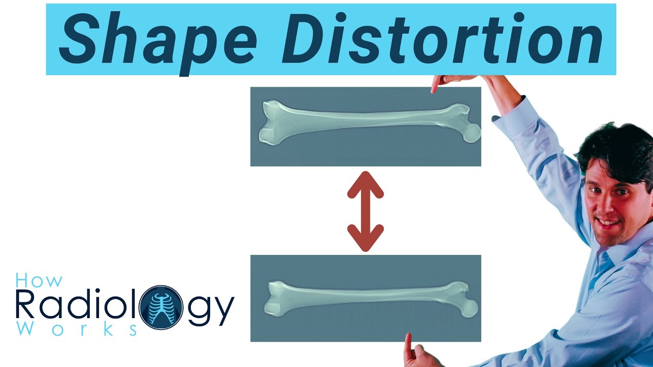 Shape distortion in Radiography (Foreshortening and Elongation)
