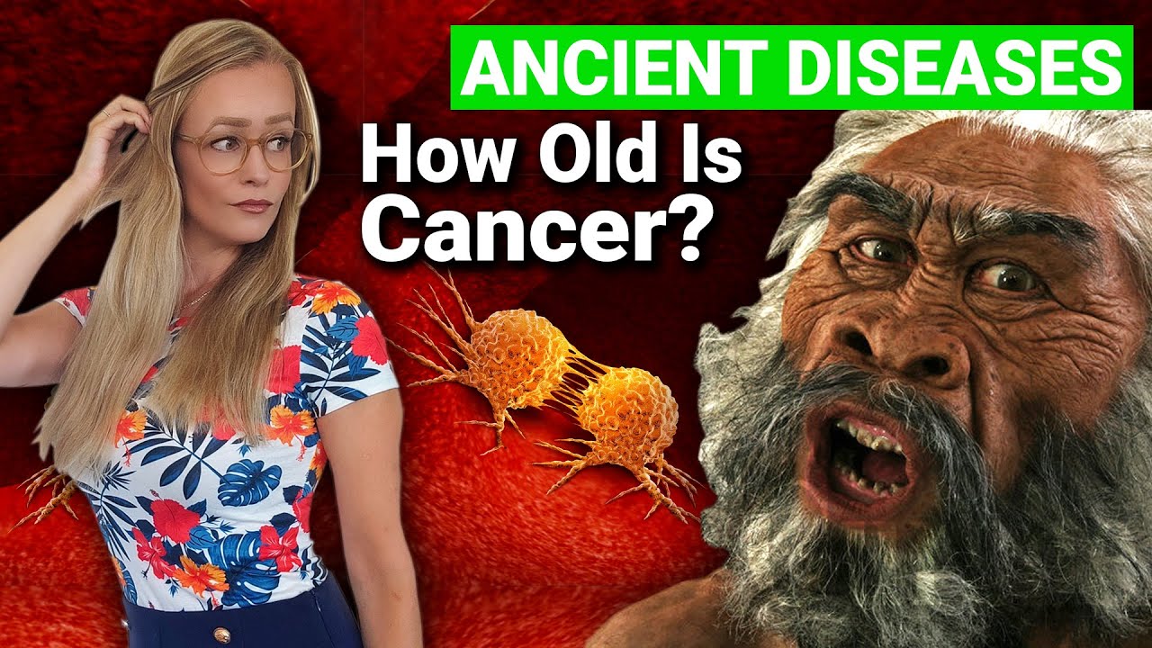 How Long Has Cancer Existed? Did It Kill Ancient Human Species?