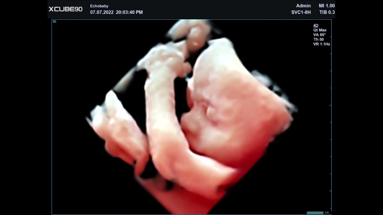 3D Pretecho 28 Weken