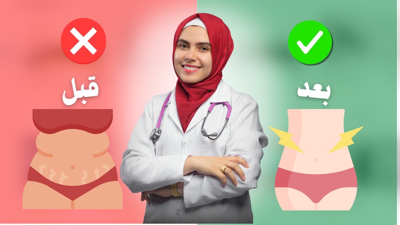 أقوى روتين لعلاج stretch marks بعد الحمل