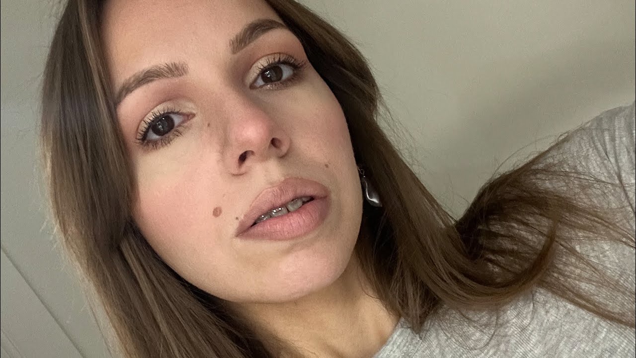 The Cons Of Wearing Braces | A Painful Few Weeks | Adult Braces Journey