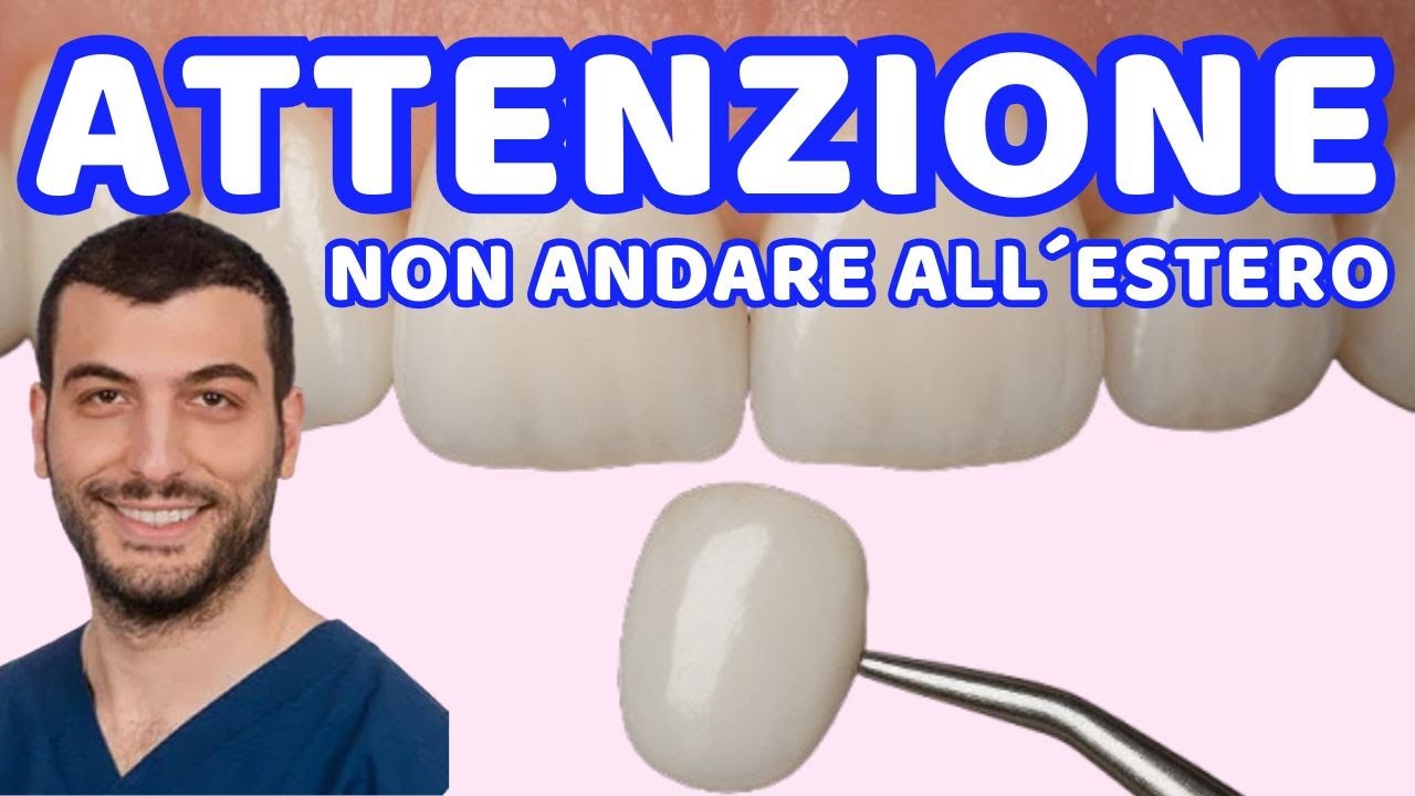 Faccette Dentali? Ti Fanno Ponti in Zirconia! Attenzione al Dentista all’Estero