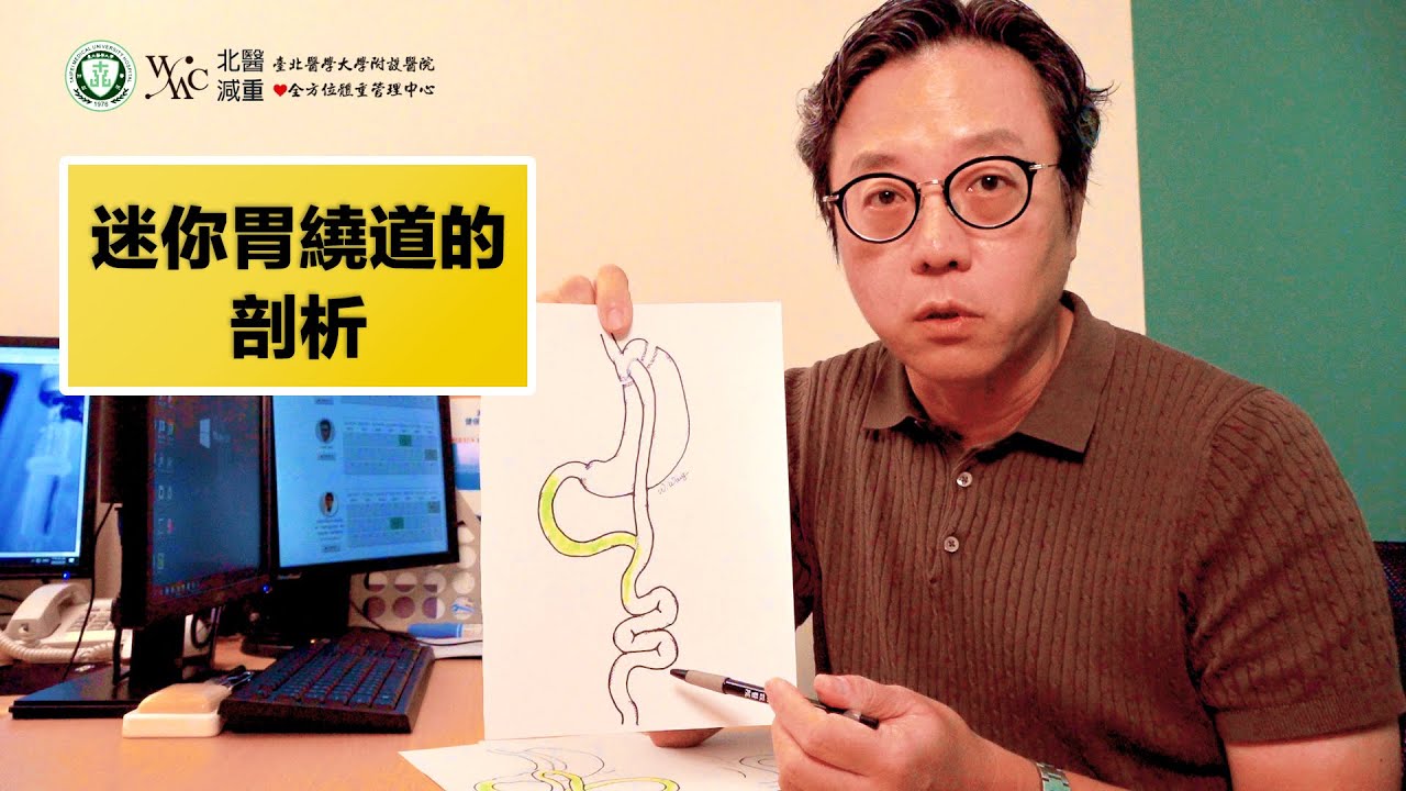 迷你胃繞道的剖析!- 聰明問醫師!!胃繞道手術有哪2種?讓王偉副院長專業示範來解答!!