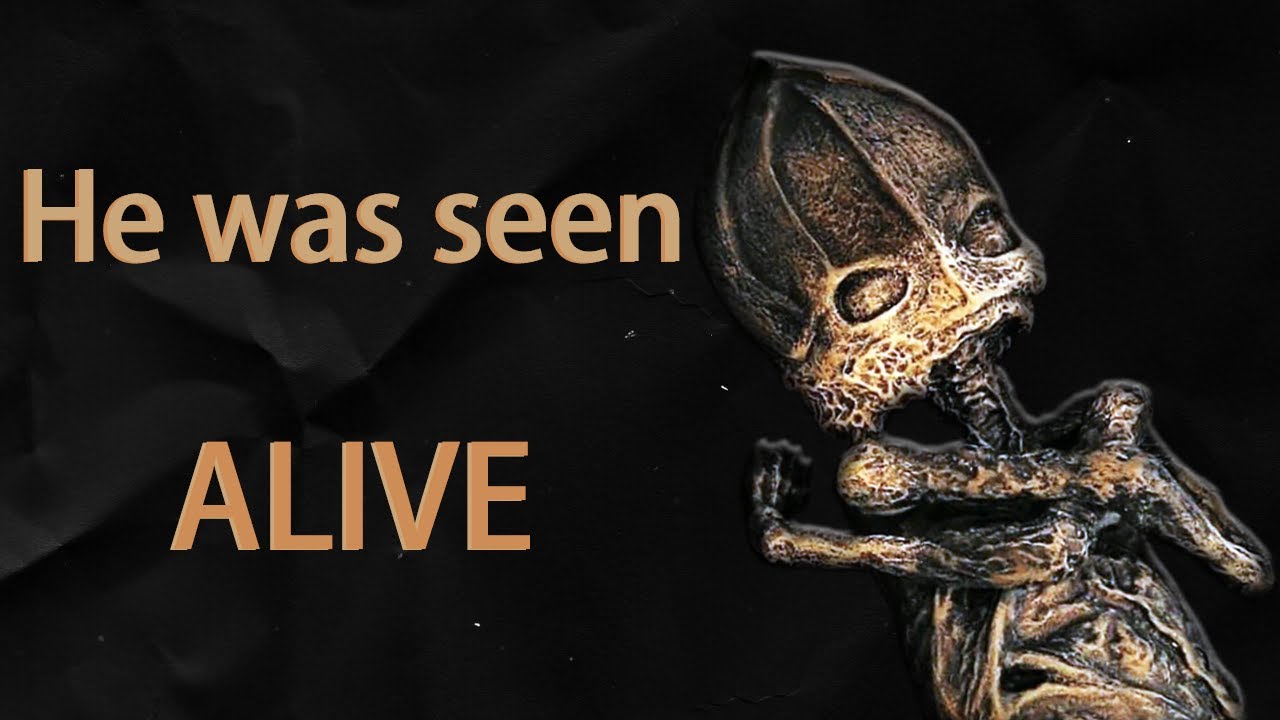Is the Kyshtym dwarf Alyoshenka real baby alien?