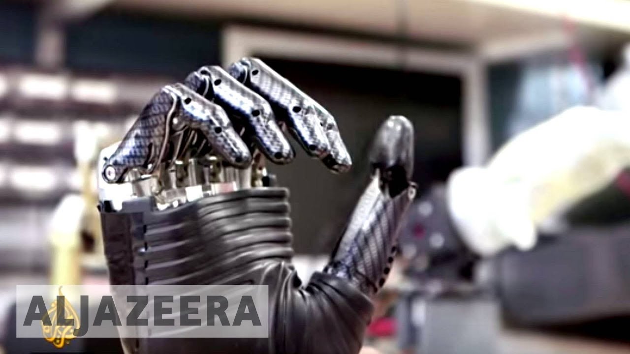 Bionic arm: A pioneering union between man and machine - The Cure