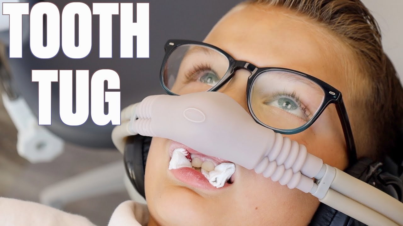 PULLING TEETH OUT WITH PLIERS | INTENSE TOOTH EXTRACTION FOR BRACES