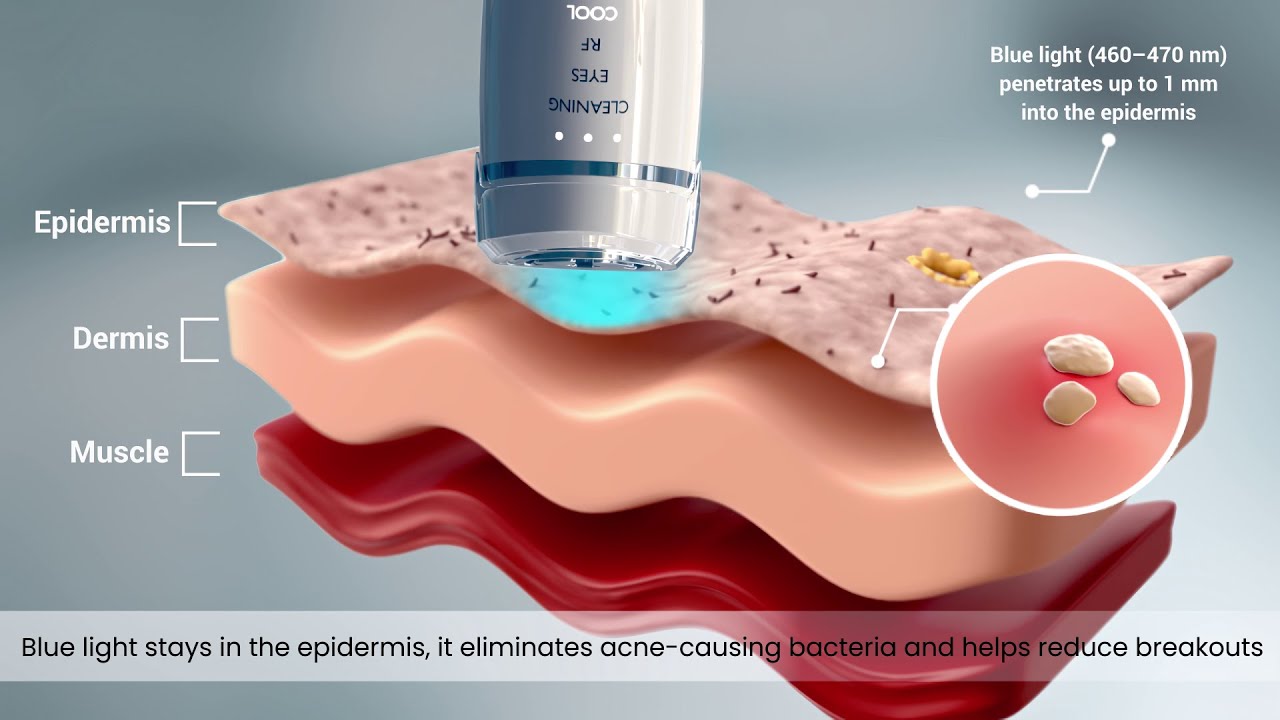How Light Therapy & EMS Transform Your Skin | 3D Medical Device Animation