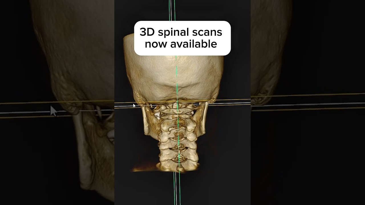 3D scans now available 