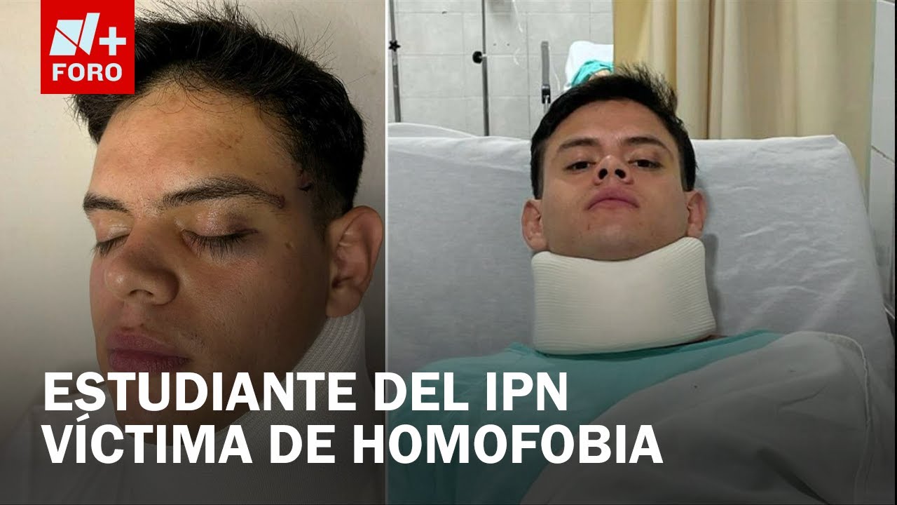 Fiscalía CDMX estanca investigación tras brutal ataque homofóbico a estudiante - Las Noticias