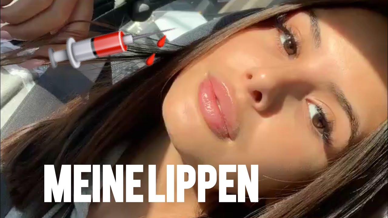 VLOGMAS #13 Alles über meine LIPPEN