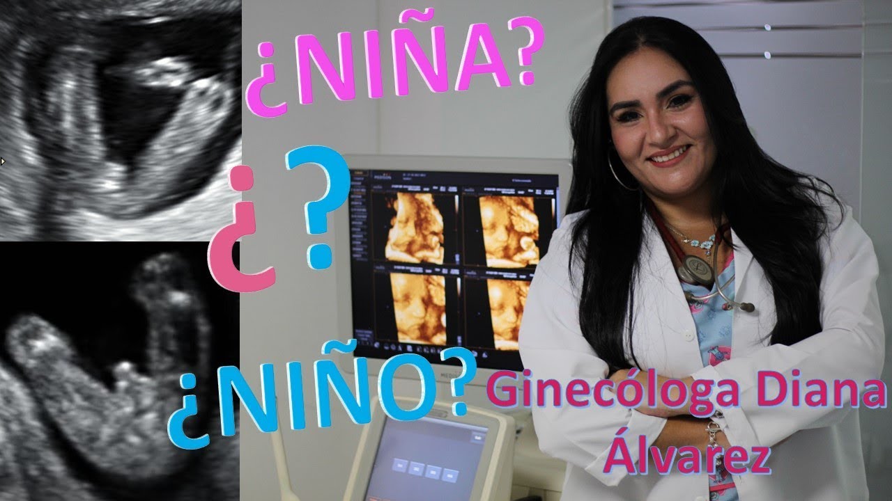 COMO SABER EL SEXO DE MI BEBE MITOS Y VERDADES POR GINEC&Oacute;LOGA DIANA ALVAREZ