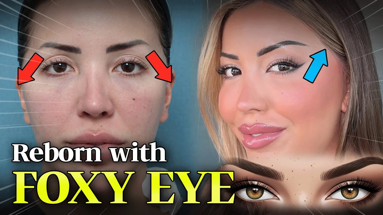 A Whole New Look with Just One Eye Surgery
