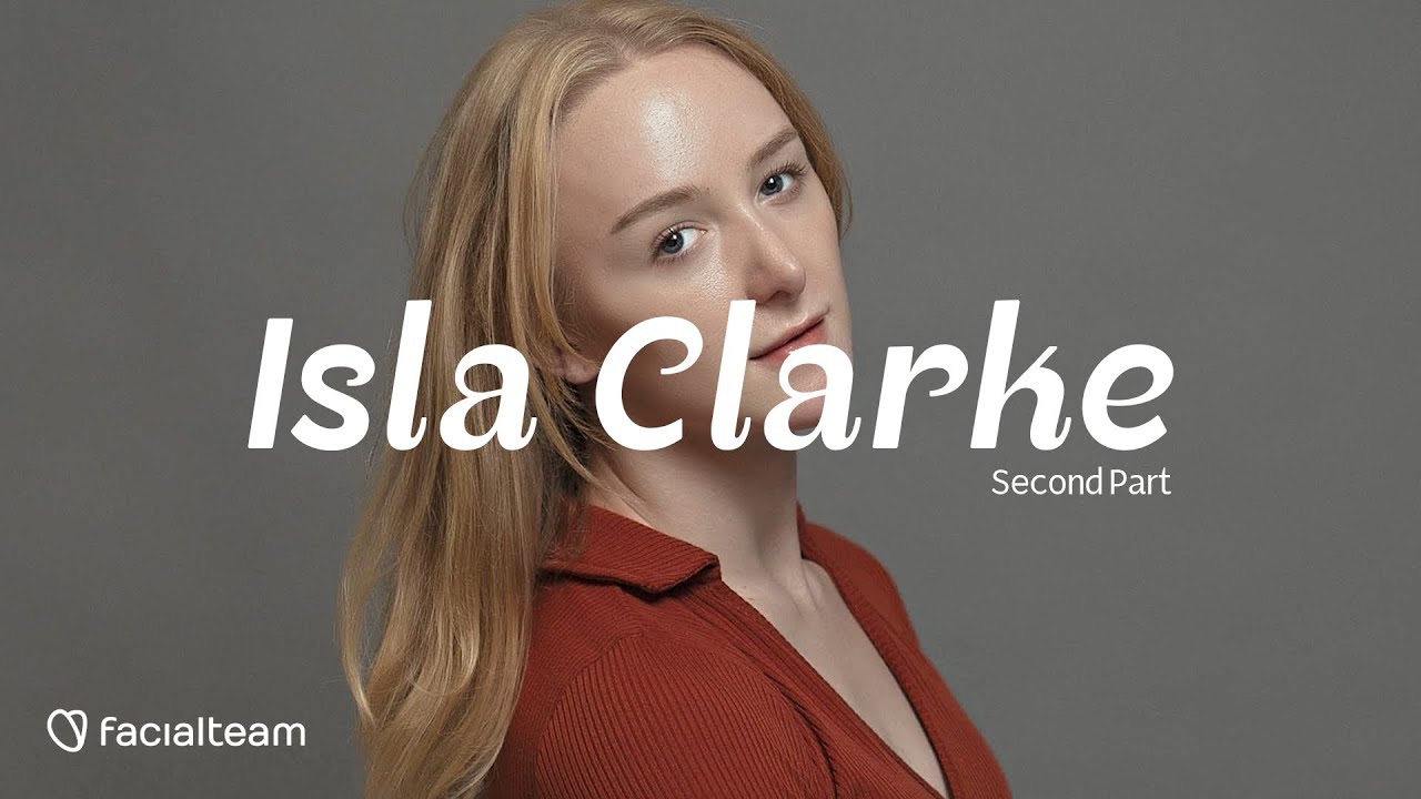 Isla, Canada — Part 2 FFS Surgery Stories