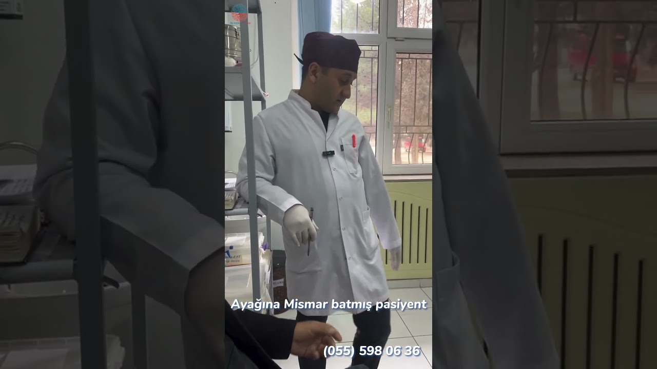 pasiyentin ayağına mismar batıb