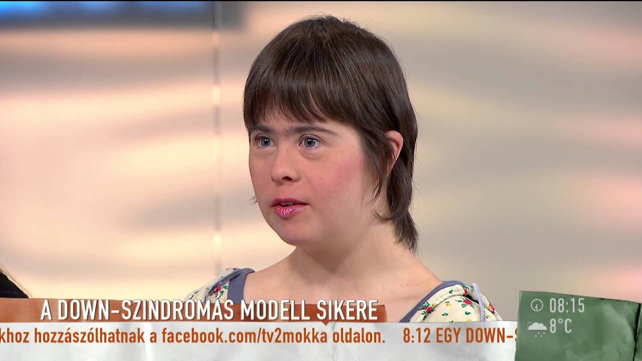 A Down-szindrómás modell sikere - 2015.10.20. - tv2.hu/mokka