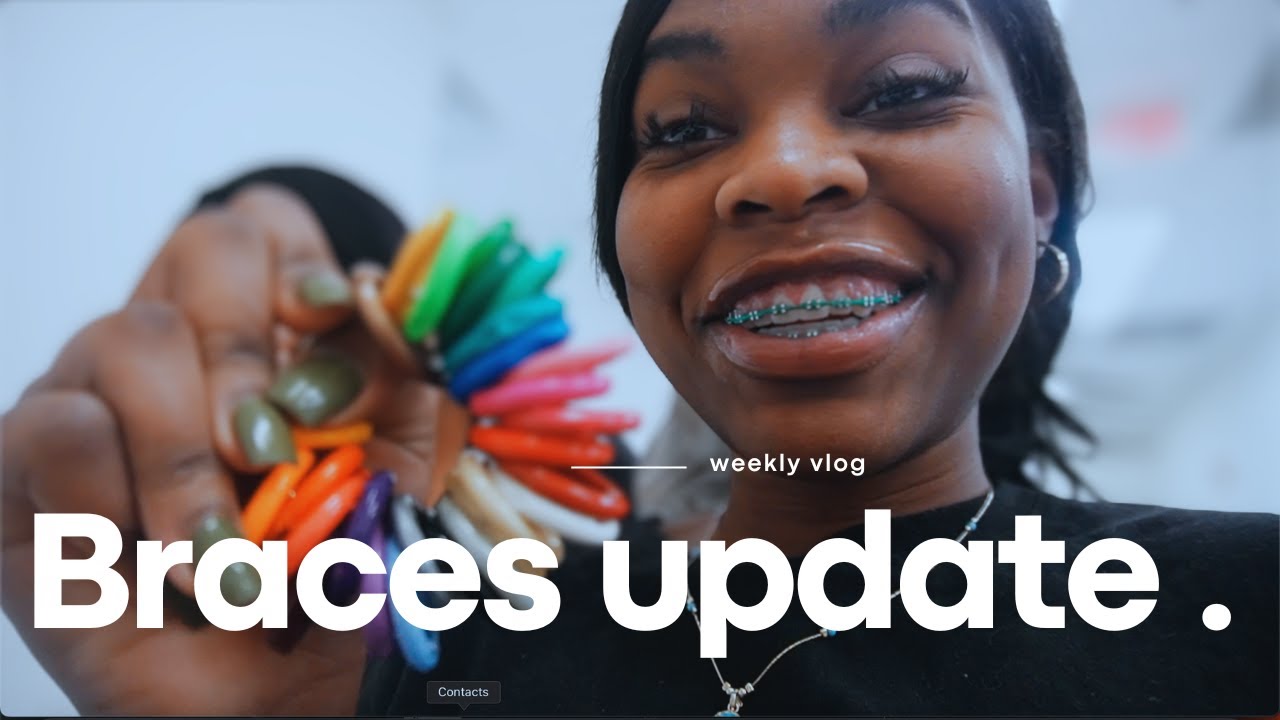 Braces Vlog : Come with me to my Braces appointment !! color change + new wire and etc....