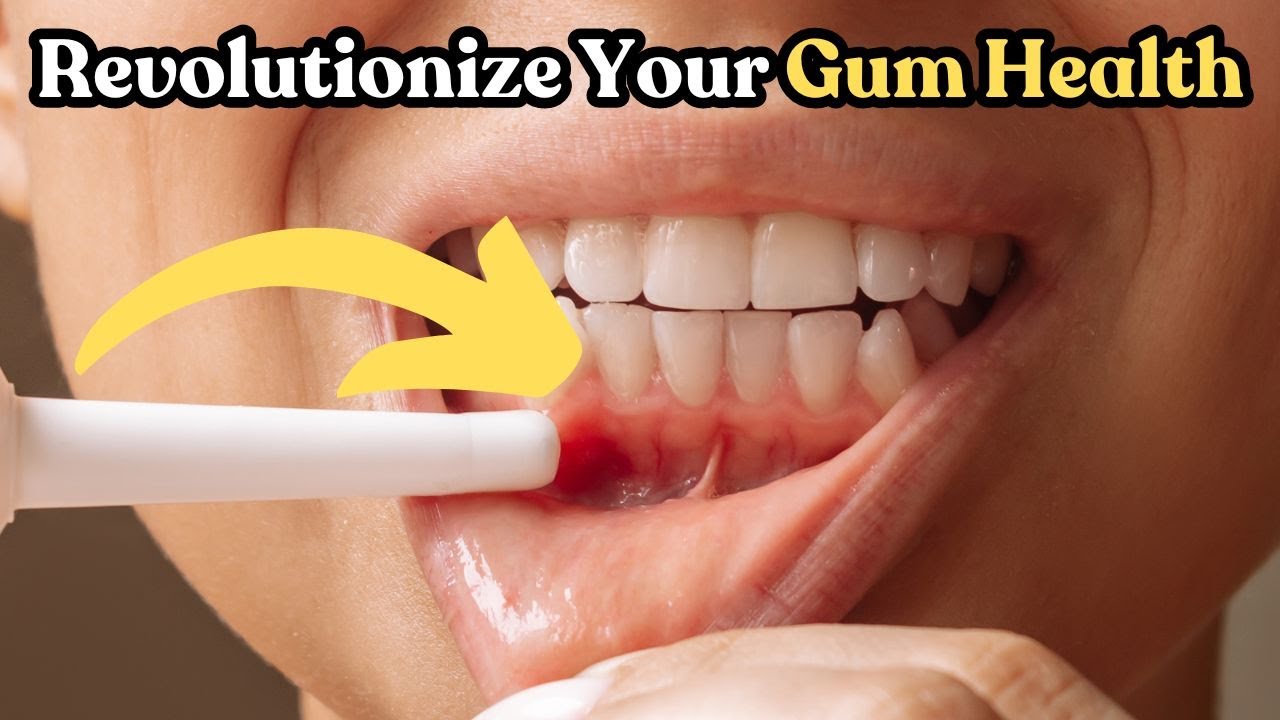 🦷 3 Amazon Finds That Will Revolutionize Your Gum Health in 2024! ✨