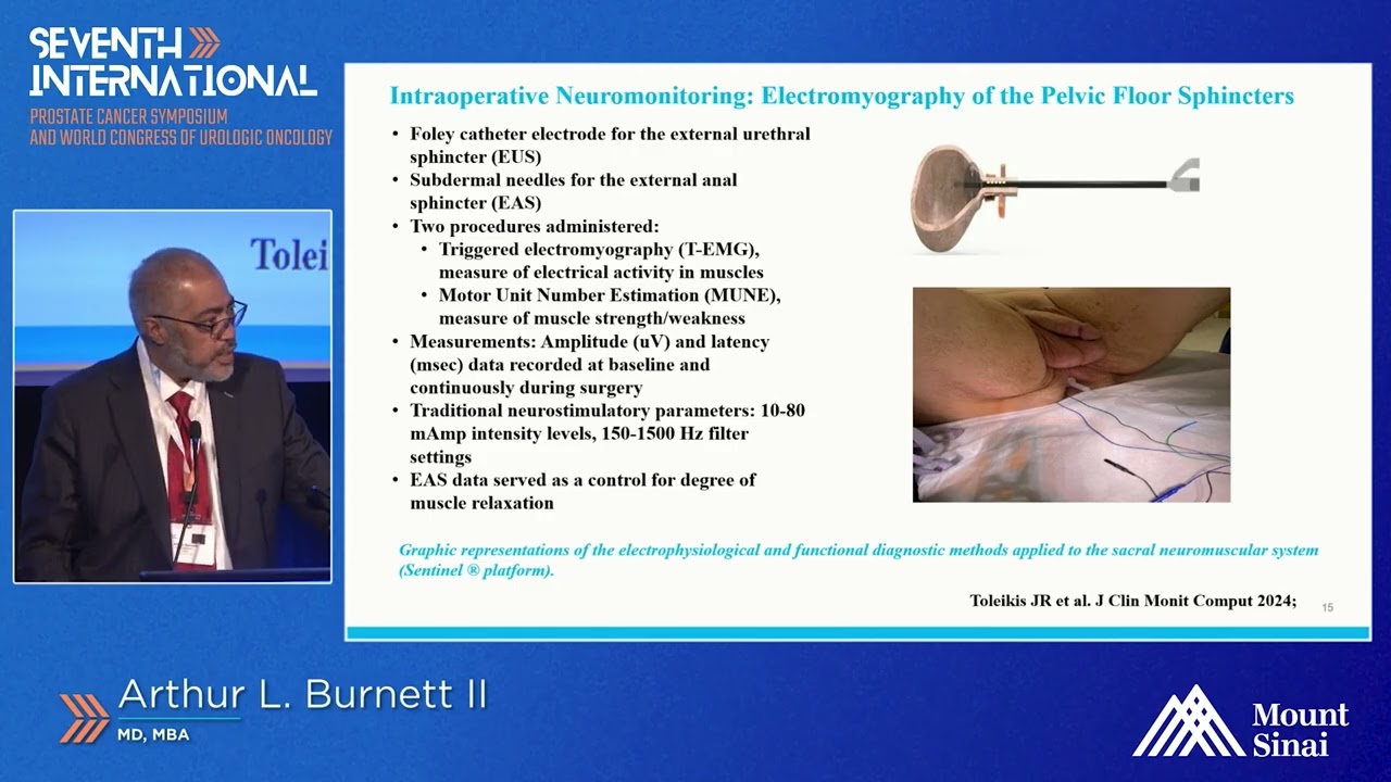 Нейромониторинг в режиме реального времени во время радикальной простатэктомии — Артур Л. Бернетт...