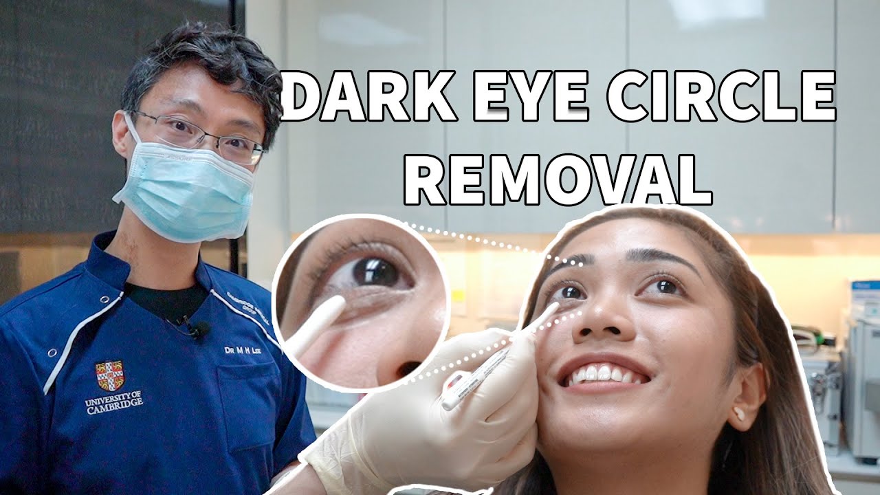 Rejuran I Treatment For Dark Eye Circles and Eyebags
