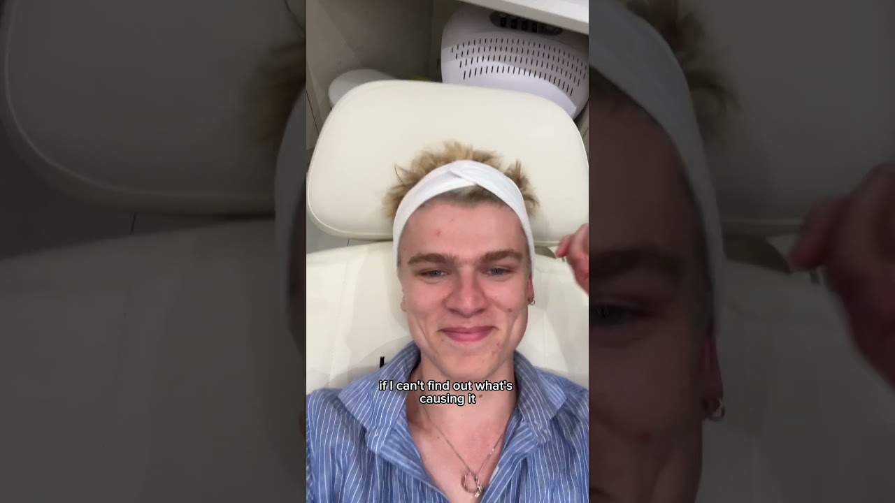 Getting perfect skin- part 2