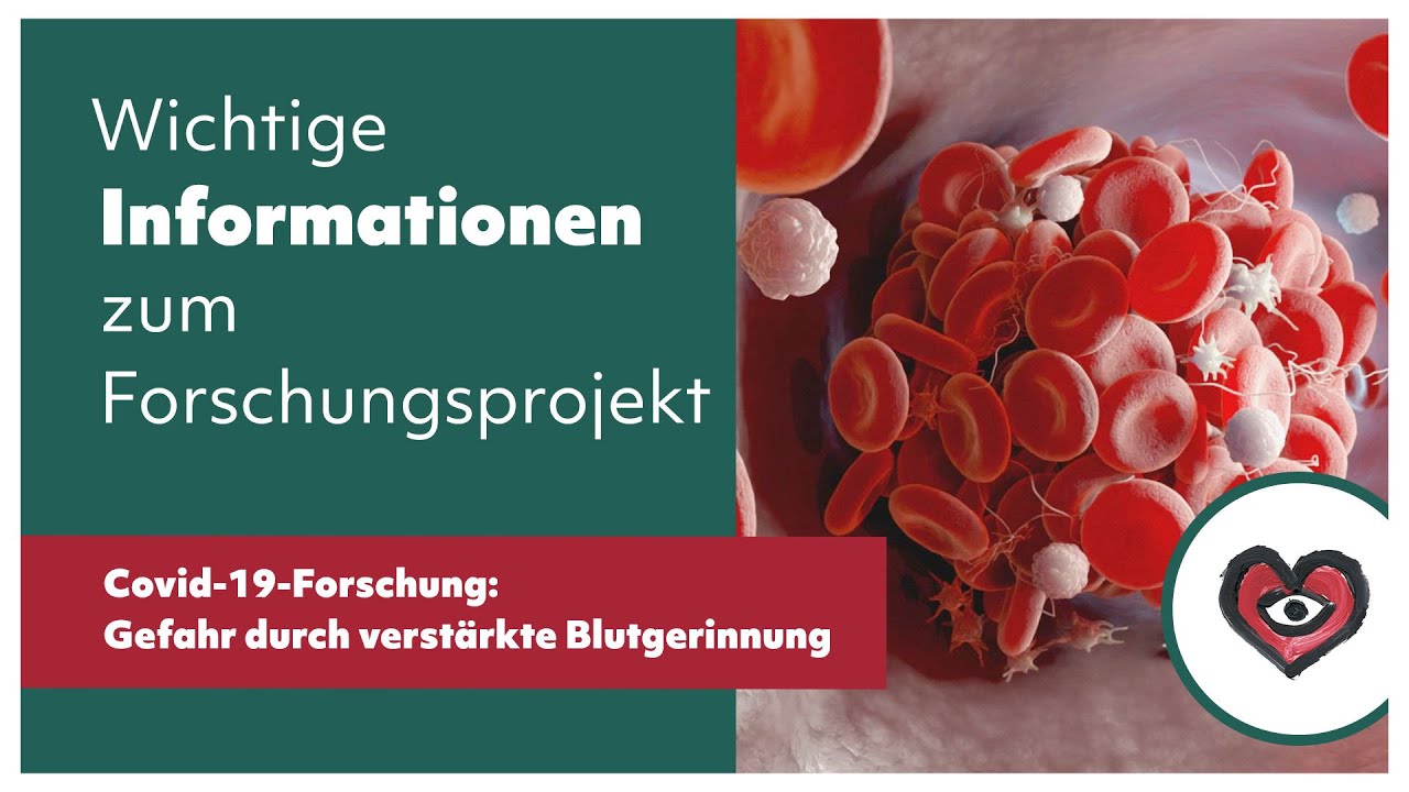 Covid-19-Forschung: Thrombosegefahr durch verstärkte Blutgerinnung