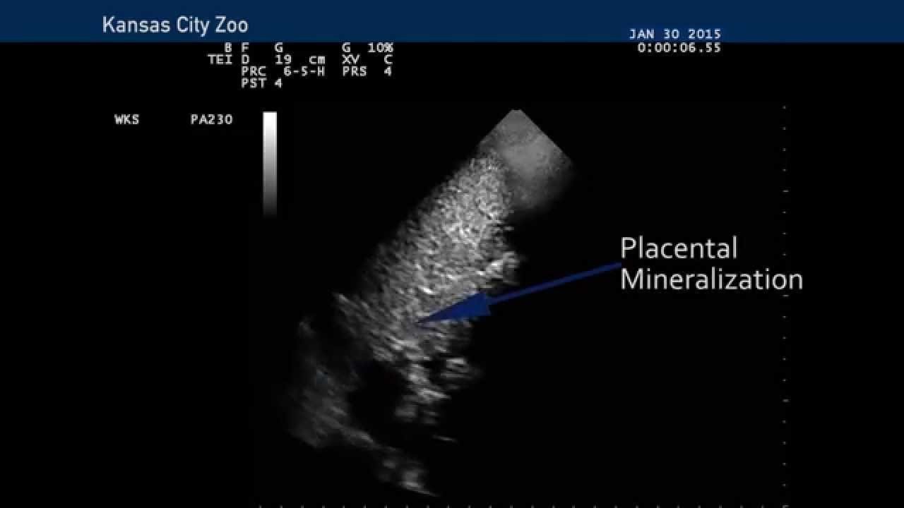 Kansas City Zoo Chimpanzee Pregnancy
