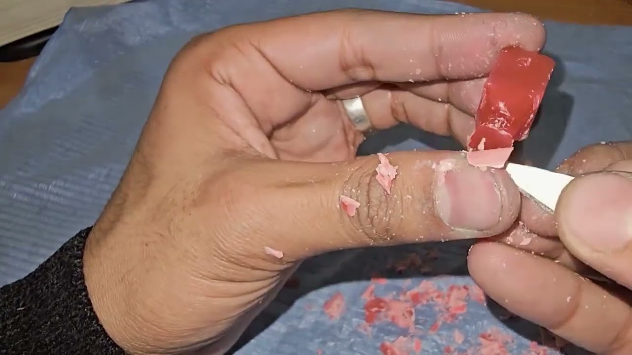 نحت الناب العلوي | Upper Canine Wax Carving د/ مختار طاهر القطني