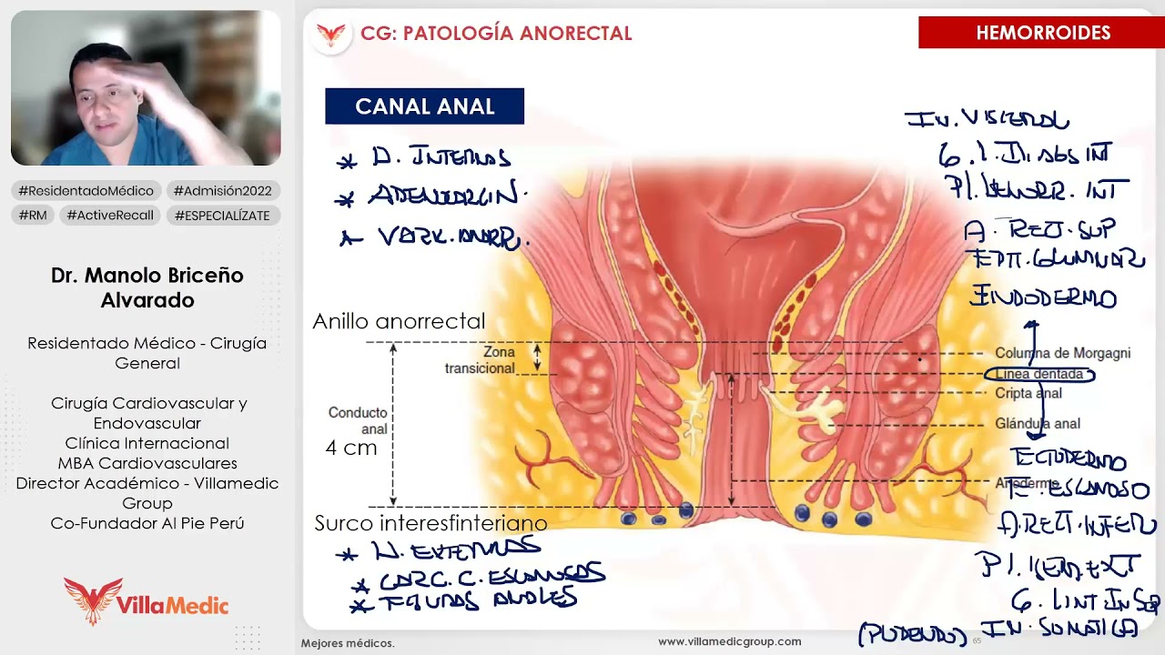 HEMORROIDES parte 1