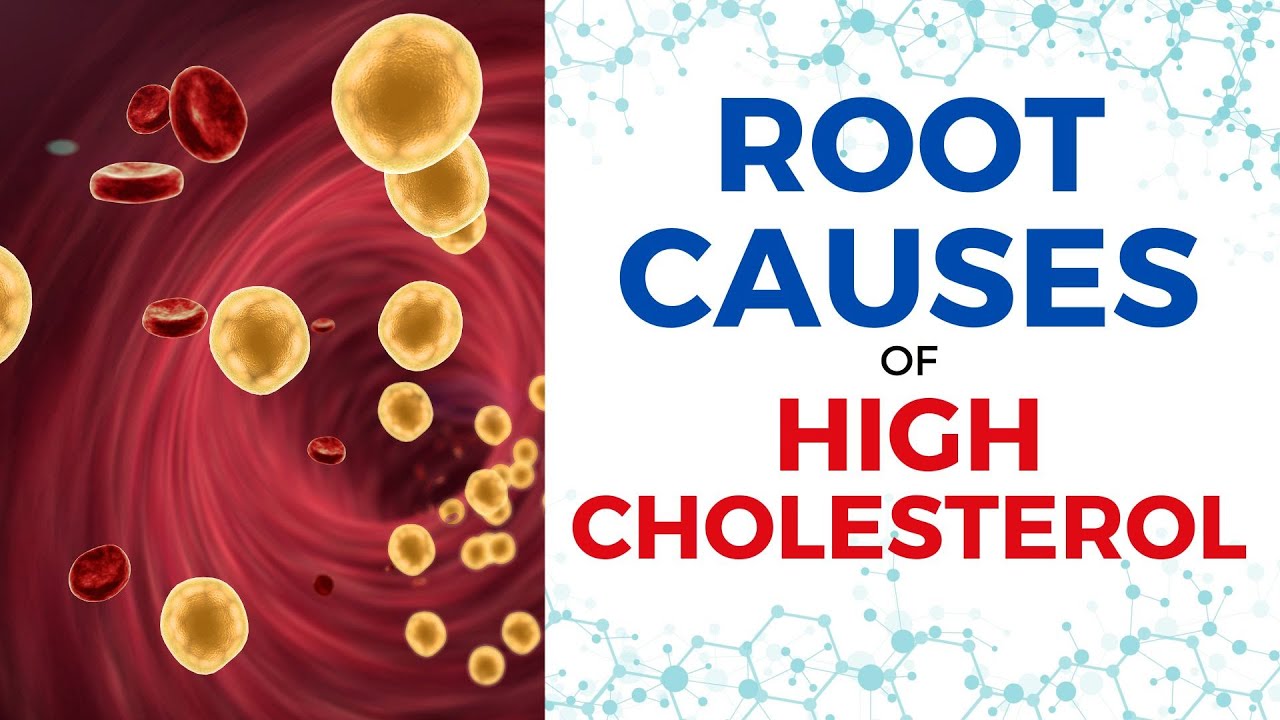Discover the Root Causes of High Cholesterol with Functional Medicine