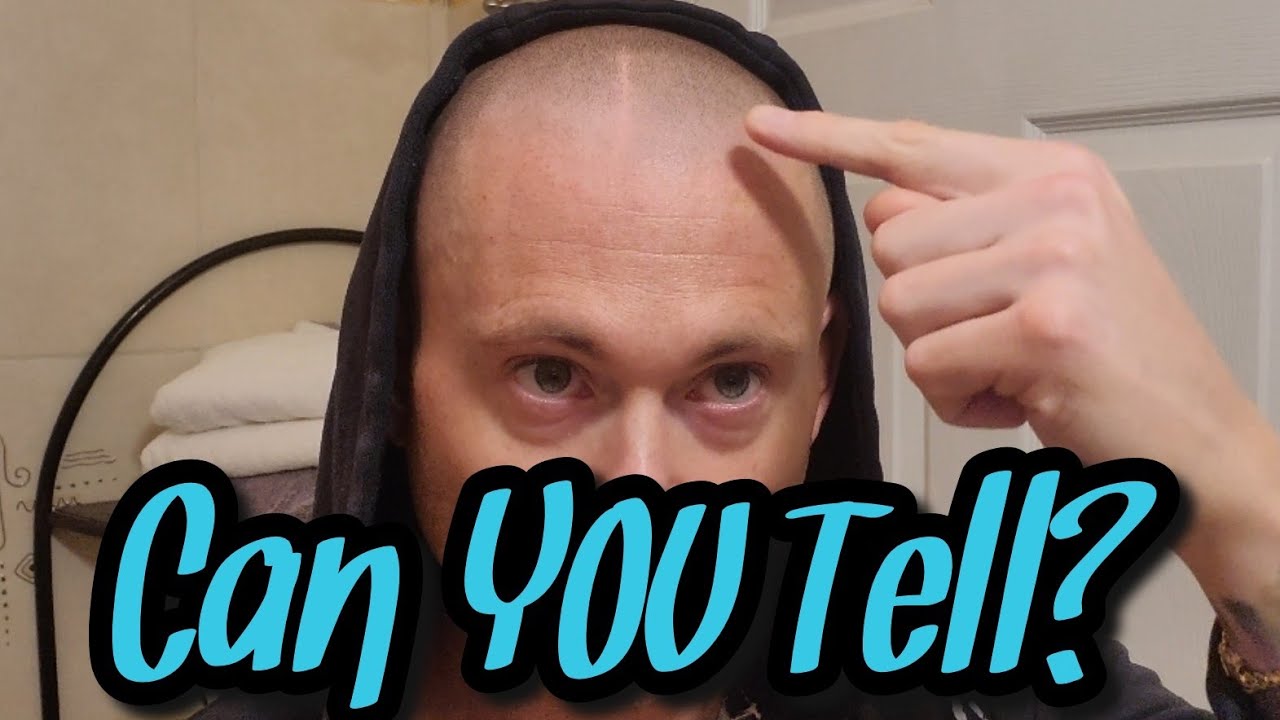 How real does scalp micropigmentation look?