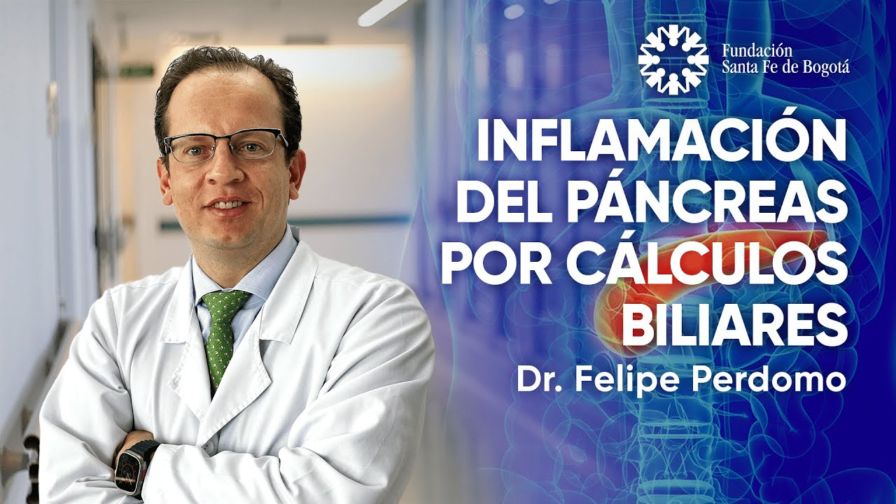 #141 Inflamación del páncreas por cálculos biliares