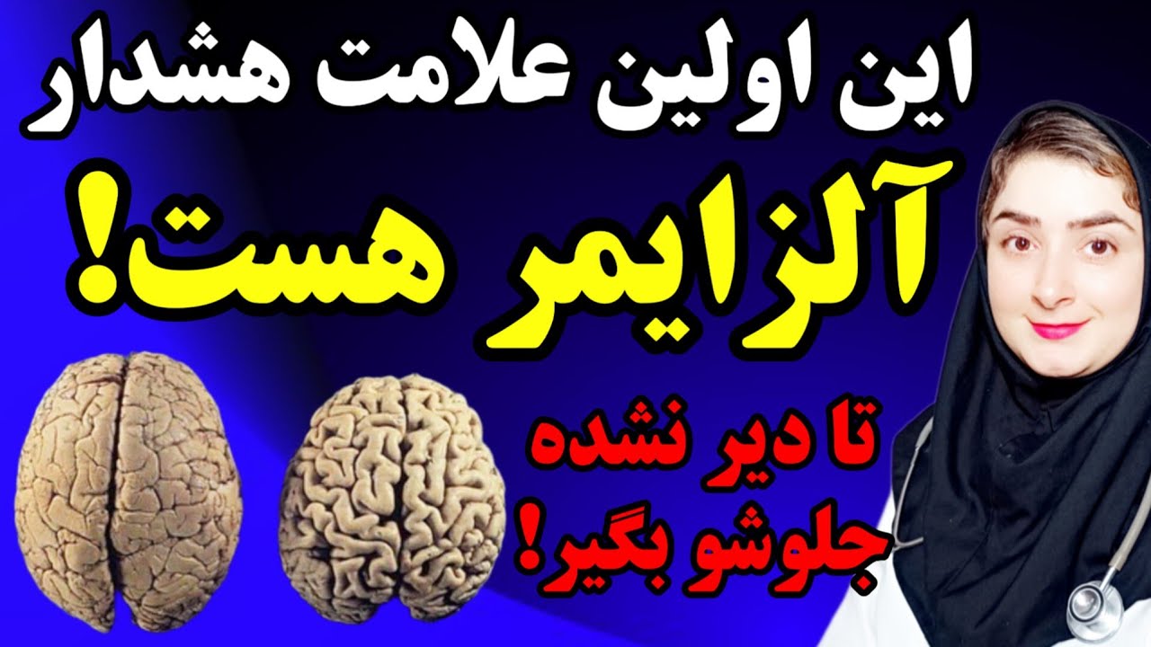 اگه متوجه این علامت اولیه آلزایمر شدی ، باید همین الان اقدام کنی|جلوگیری از آلزایمر،علائم و درمان