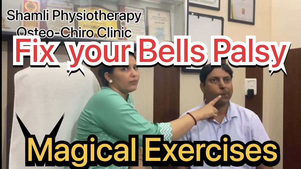 #bellspalsy Exercises||Shamli Physiotherapy||Dr.Jitendra Singh(PT)Dr.Amrita Singh(PT)