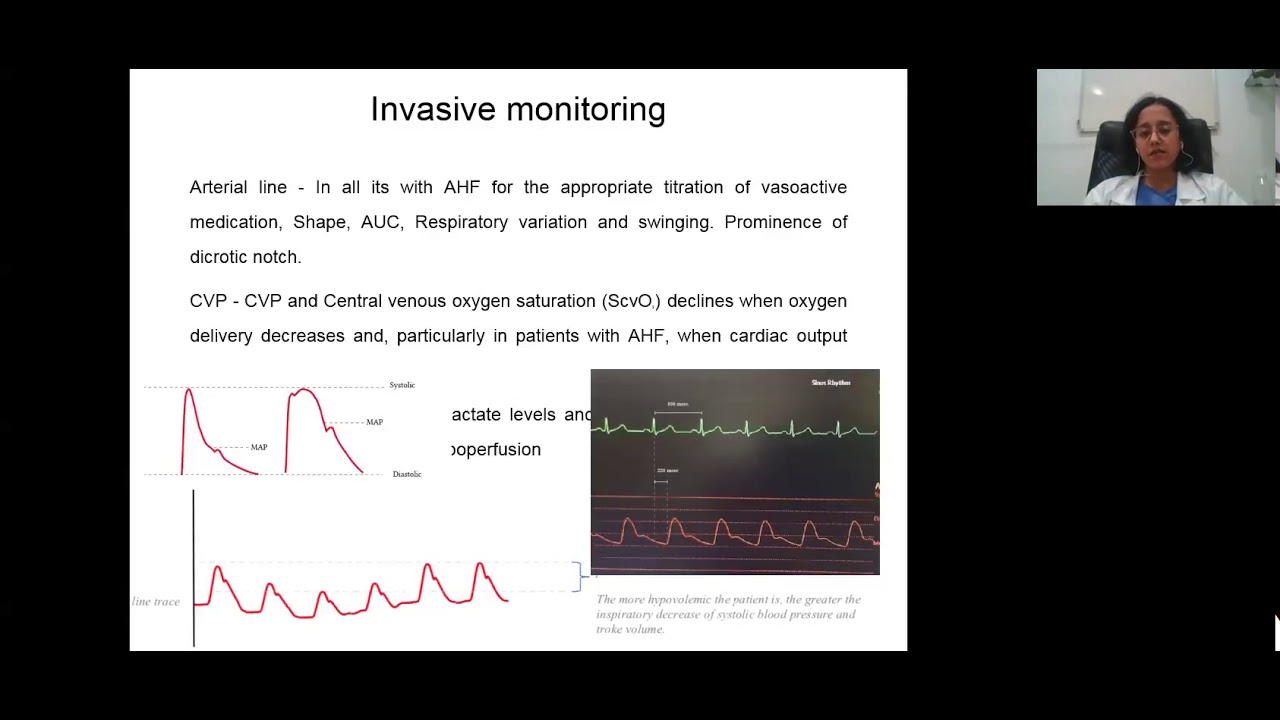 Managing acute heart failure in ICU by Dr Tanuja Karande