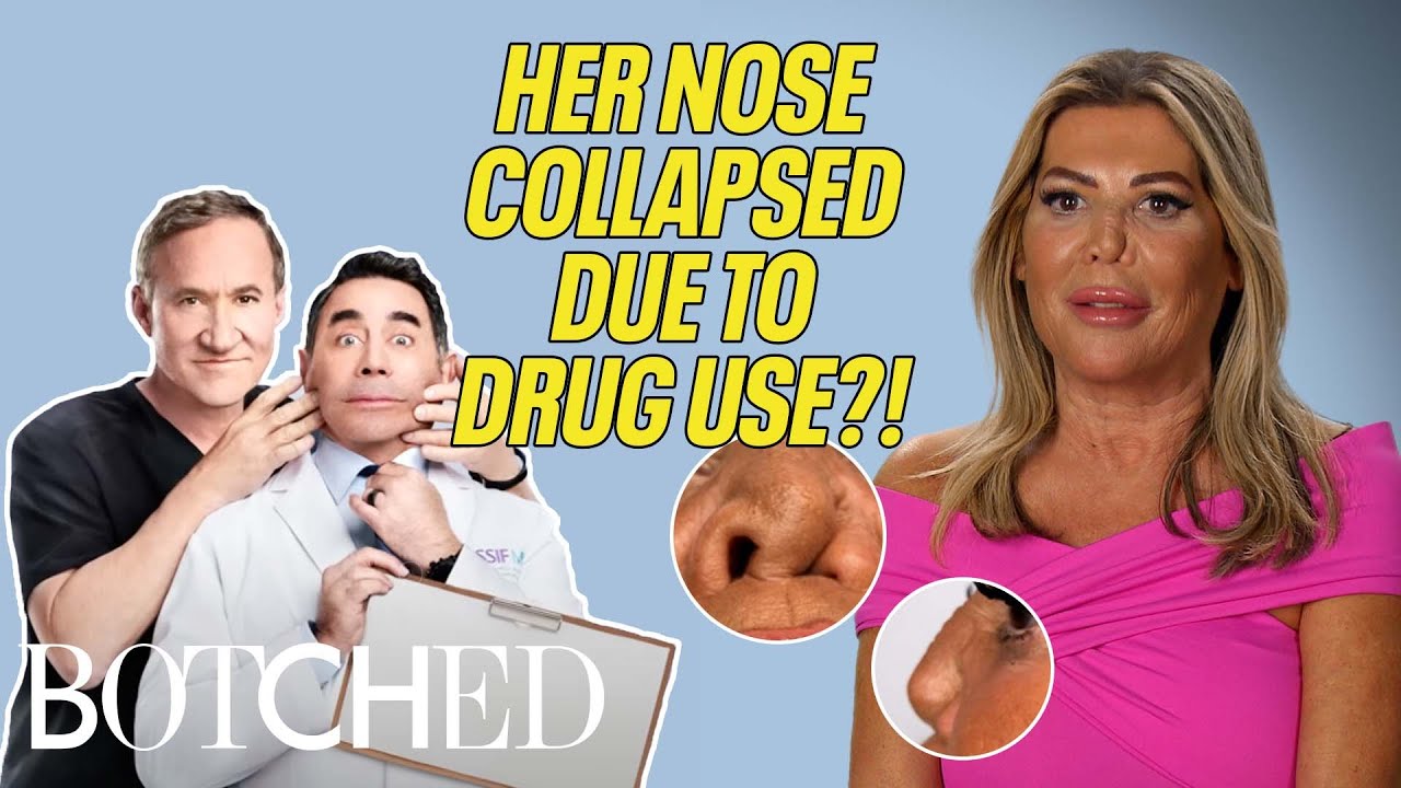 British Demi Moore Was A 365 Party Girl and It DESTROYED Her Nose?! (Before & After) | Botched | E!