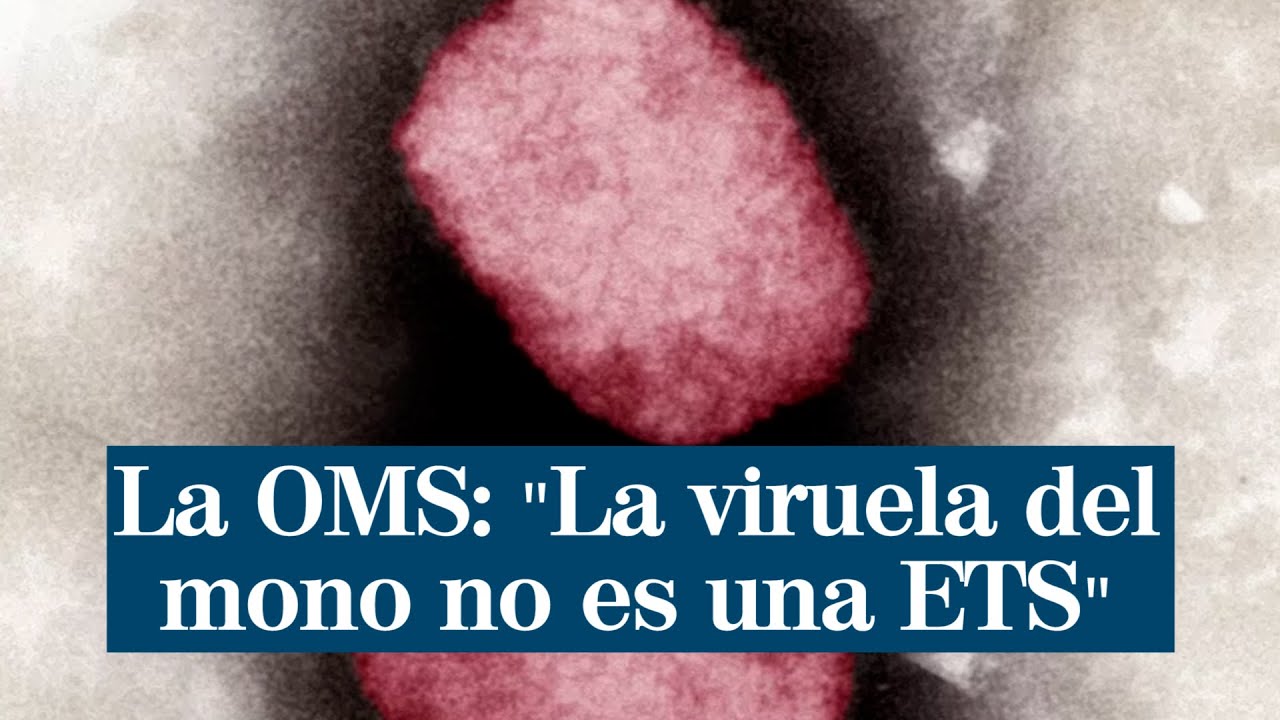 La OMS insiste en que la viruela del mono no es una enfermedad de transmisi&oacute;n sexual