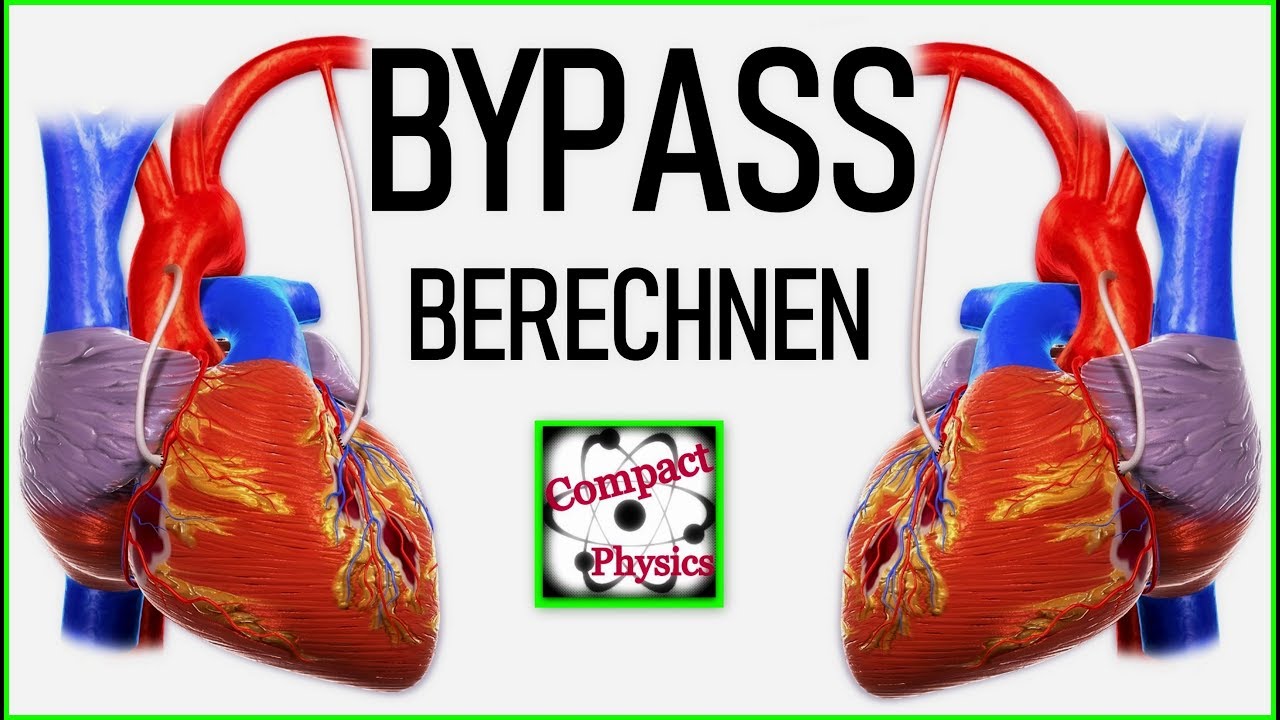 So berechnet man einen BYPASS [Compact Physics]