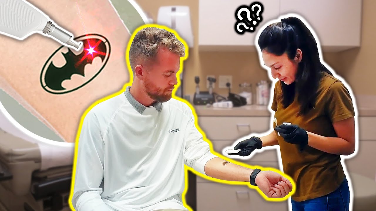 Trying to Get a Temporary Tattoo Laser Removed