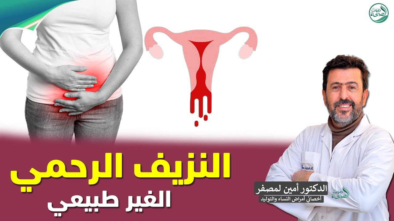 النزيف الرحمي الغير طبيعي اسبابه والعلاج | د. أمين لمصفر أخصائي أمراض النساء والتوليد