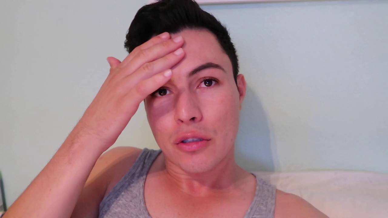CAMINANDO Y MIENDO + LASER EN LA CARA | VLOG 123 | YASMANY