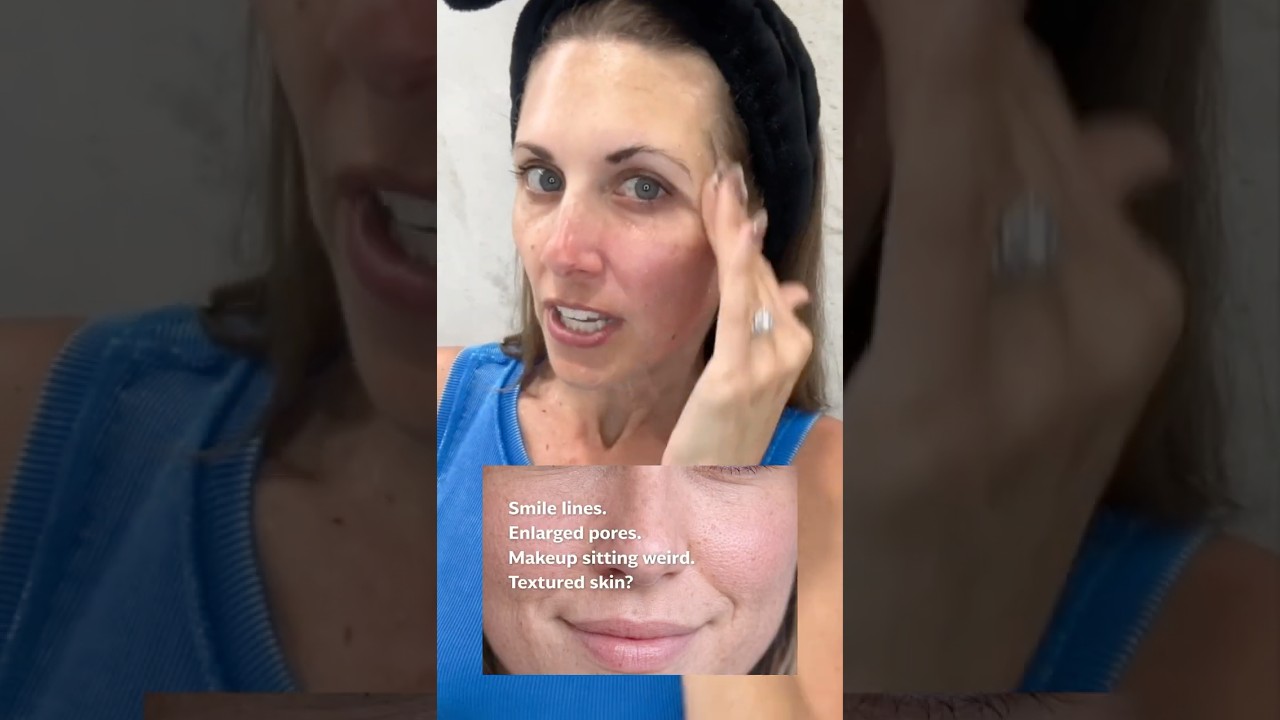 Poprawa tekstury sk&oacute;ry po 40. roku życia dzięki Skinn DermAppeal