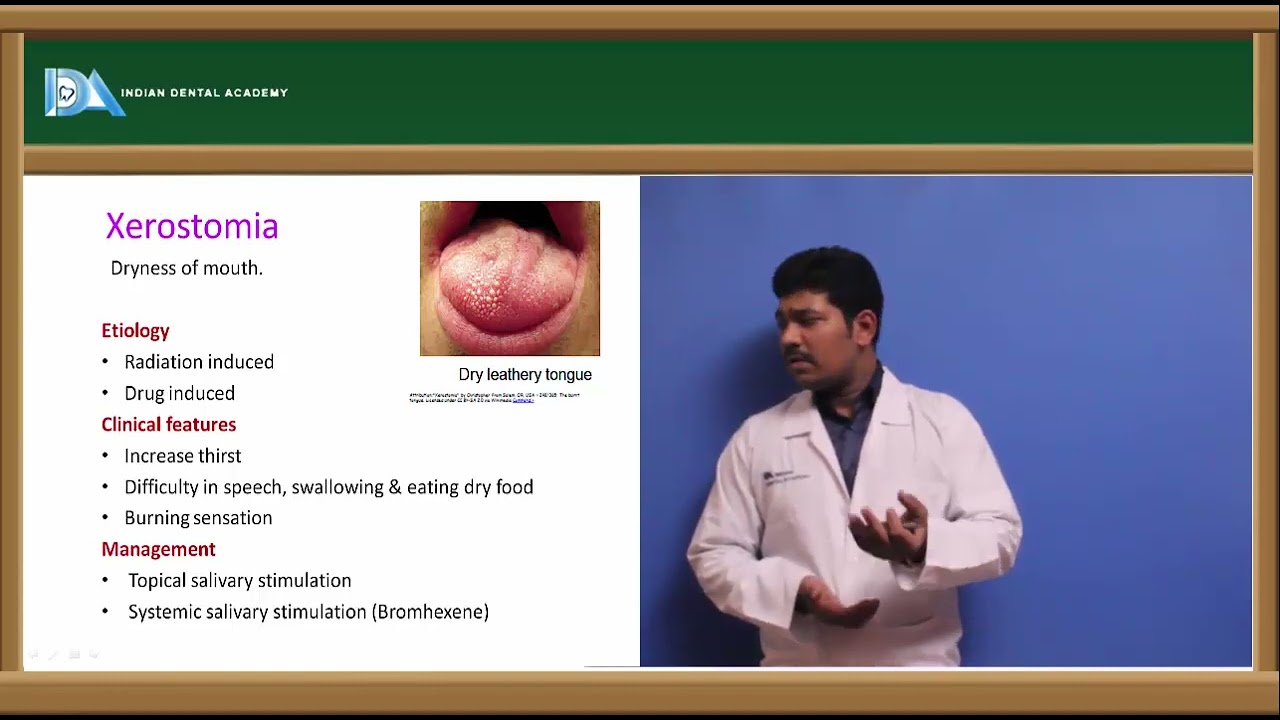 SALIVARY GLANDS