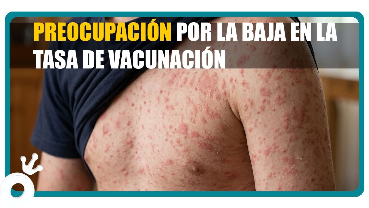Preocupación por la baja en la tasa de vacunación