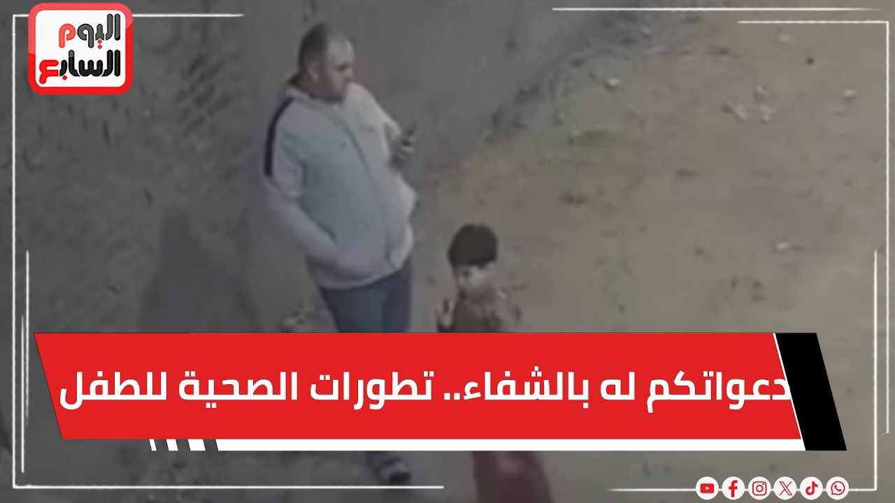 دعواتكم له بالشفاء.. تطورات الحالة الصحية للطفل ضحية واقعة باسوس بالقليوبية.. بعد اصابته بطلق خرطوش