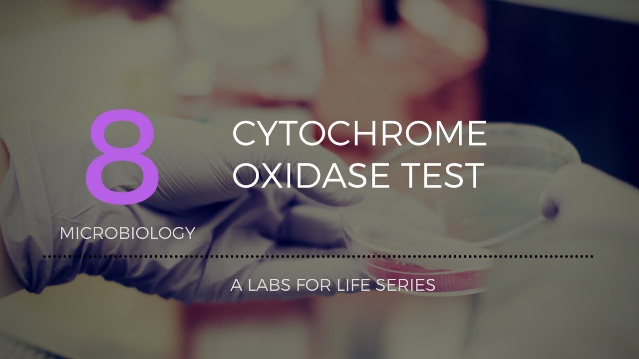 Cytochrome Oxidase Test