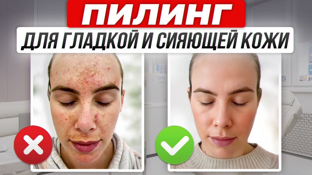 СОДА НА ЛИЦЕ — это не скраб. Вот что она делает на самом деле